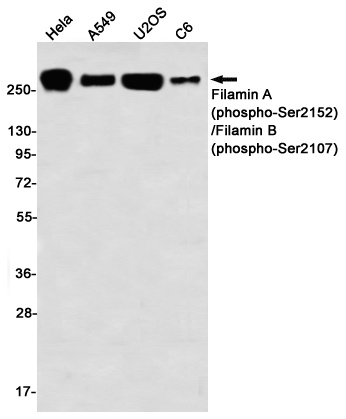 Phospho-Filamin A/B (Ser2152/Ser2107) Rabbit mAb