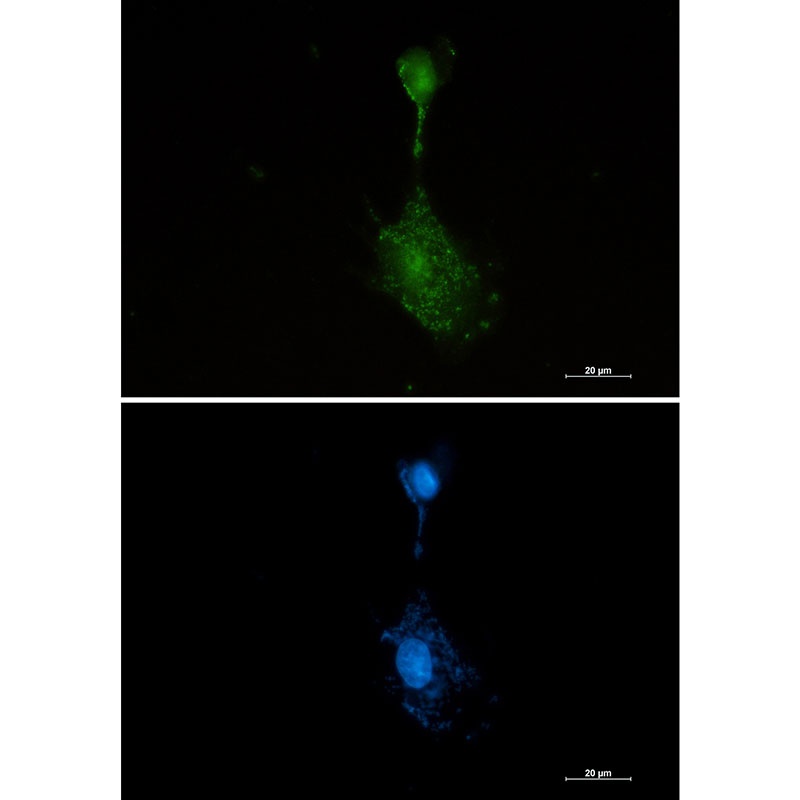 RSK3 Rabbit mAb