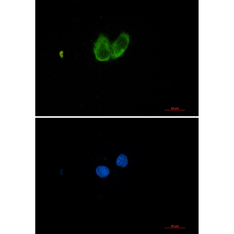 ZYX Rabbit mAb