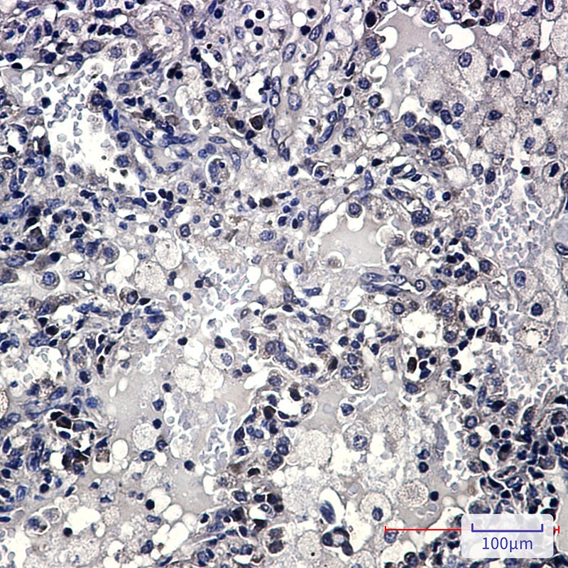 ZYX Rabbit mAb