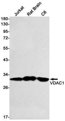 VDAC1 Rabbit mAb