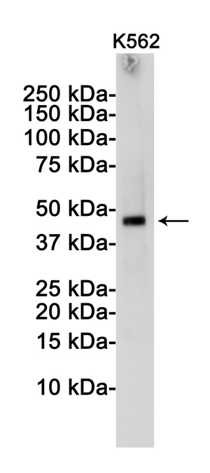 TSG101 Rabbit mAb