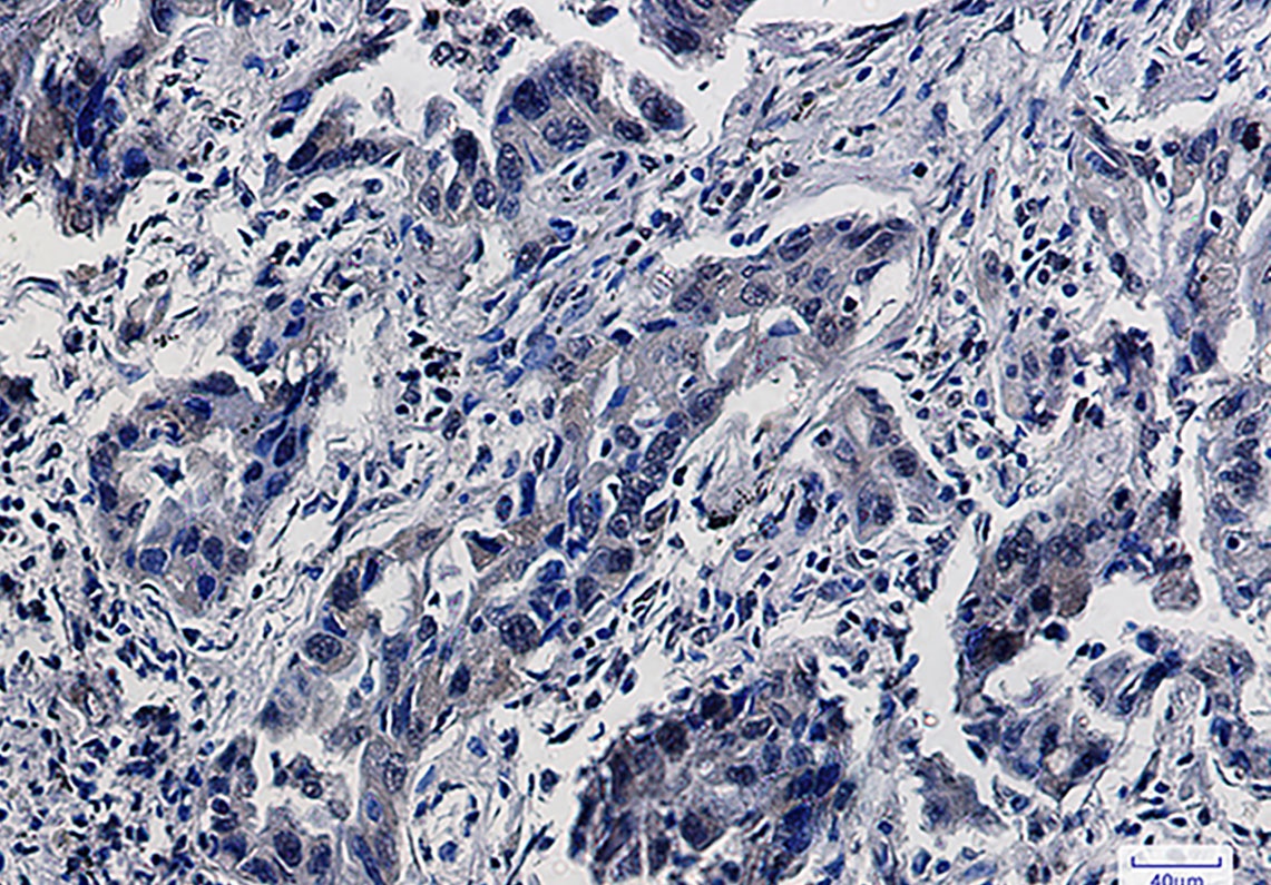 Smad5 Rabbit mAb