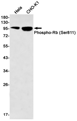 Phospho-Rb (Ser811) Rabbit mAb