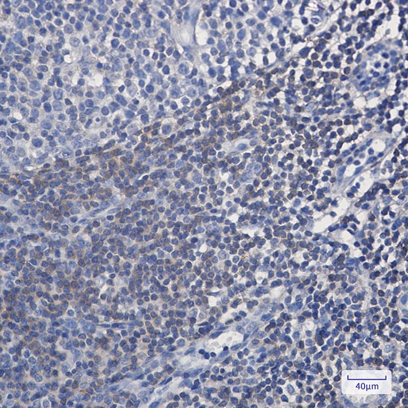 BIN1 Rabbit mAb