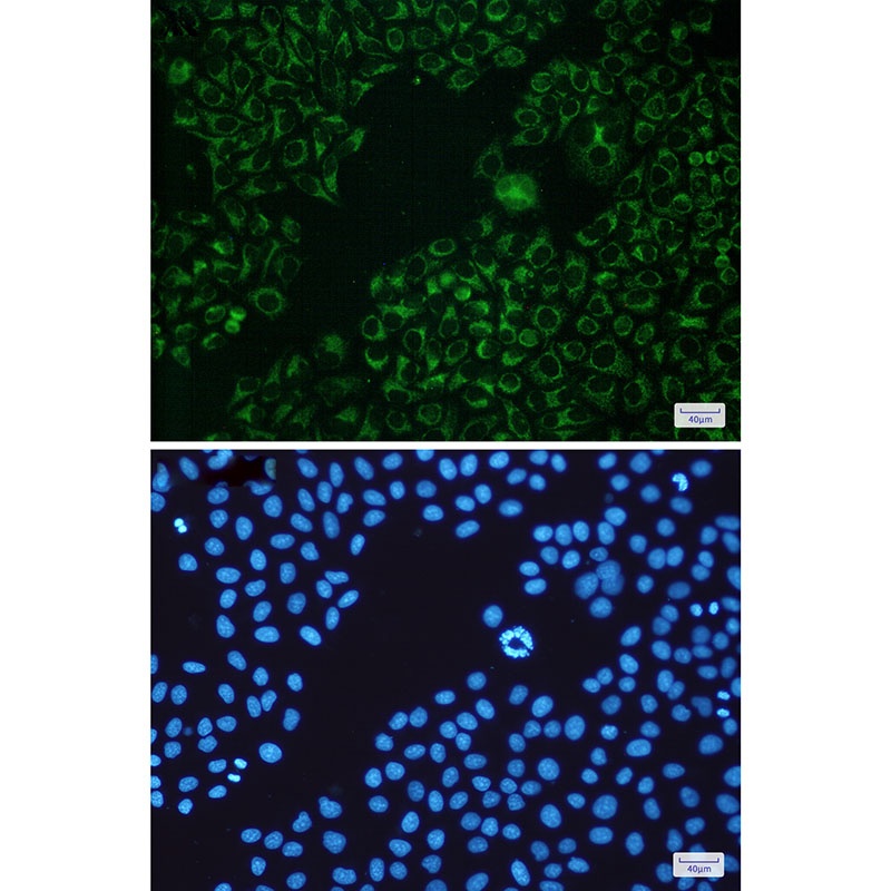 Bad Rabbit mAb