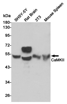 CaMKII Rabbit pAb