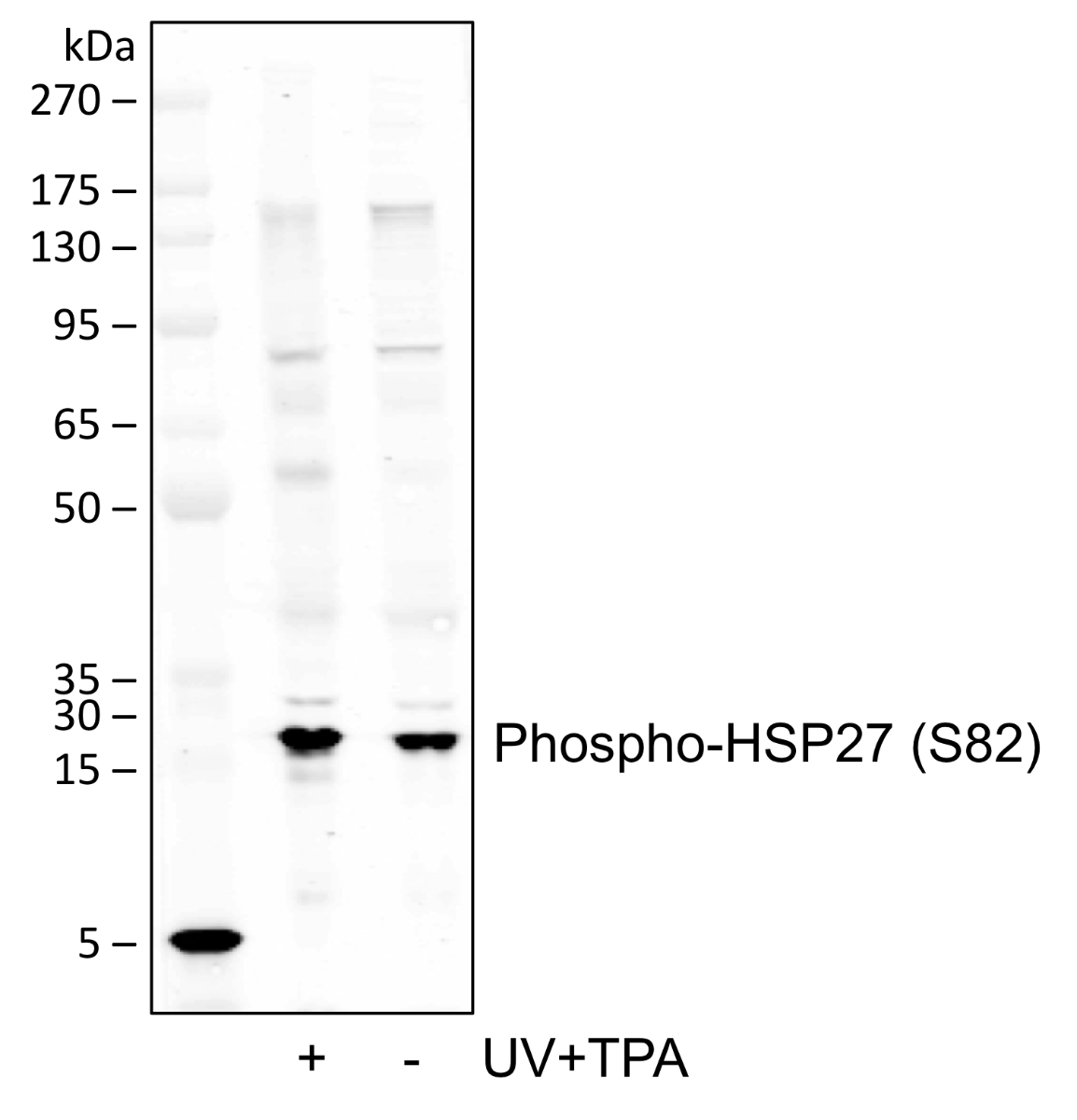 Phospho-HSP27 (Ser82) (CB2) rabbit mAb