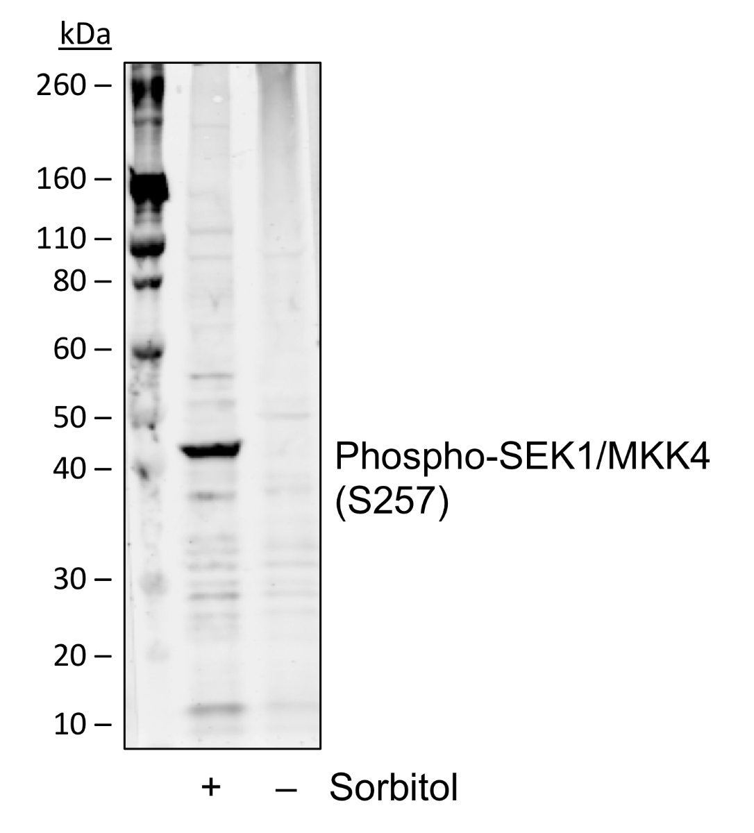 Phospho-SEK1/MKK4 (Ser257) (C5) rabbit mAb