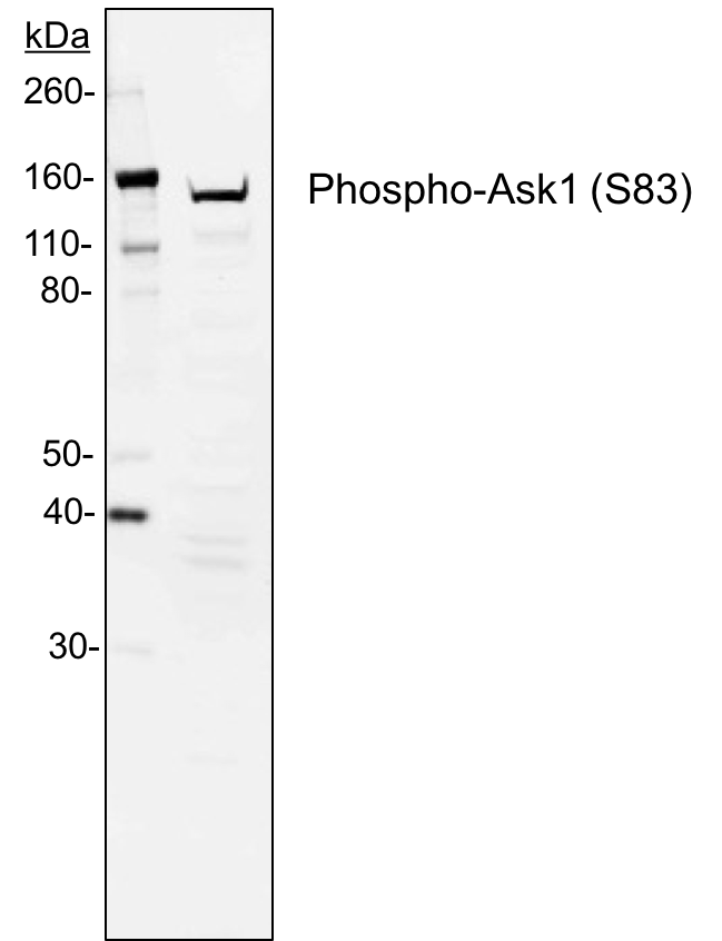 Phospho-Ask1 (Ser83) (G4) rabbit mAb