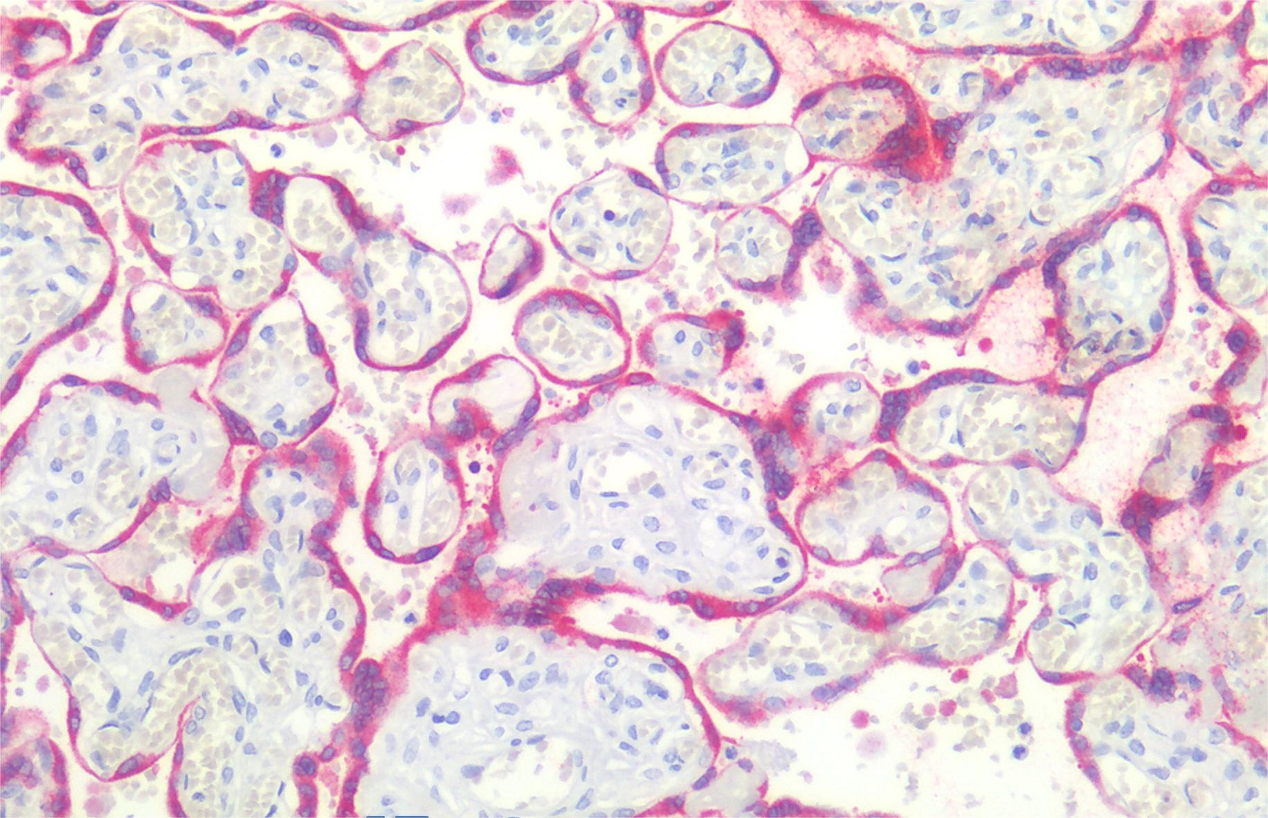Anti-Hu BCL2 Purified