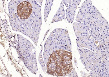CaIPLA2 Rabbit Polyclonal Antibody
