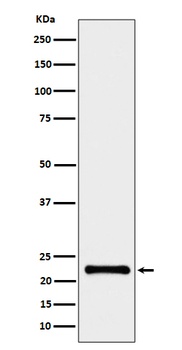 Anti-CRCP Rabbit Monoclonal Antibody