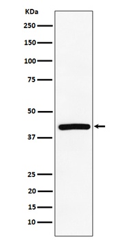 Anti-TMEM43 Rabbit Monoclonal Antibody