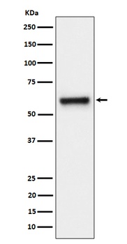 Anti-FPGS Rabbit Monoclonal Antibody