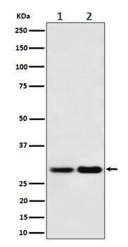 Anti-MTAP Rabbit Monoclonal Antibody