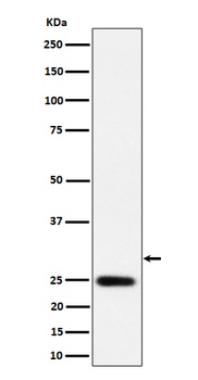 Anti-NAT1 Rabbit Monoclonal Antibody
