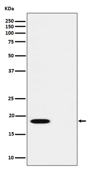 Anti-Phospho-PTS (S19) Rabbit Monoclonal Antibody