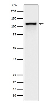Anti-Phospho-CBL (Y774) Rabbit Monoclonal Antibody