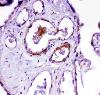 Angiotensin Converting Enzyme 1/ACE Antibody