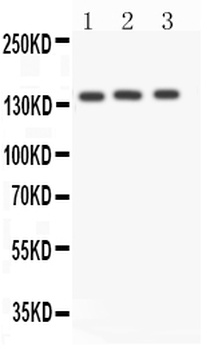 Angiotensin Converting Enzyme 1/ACE Antibody
