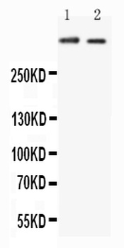 Huntingtin/HTT Antibody
