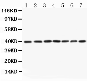 MEK3/MAP2K3 Antibody