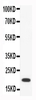 Macrophage Inflammatory Protein 4/CCL18 Antibody