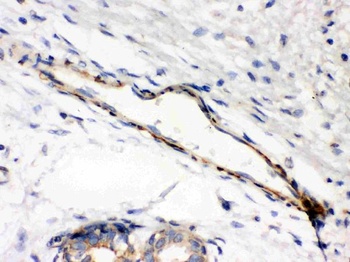 Anti-Caldesmon (Smooth) Cald1 Antibody (Monoclonal, hHCD)