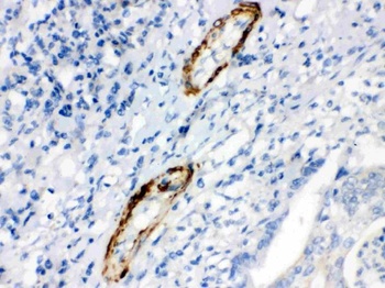 Anti-Caldesmon (Smooth) Cald1 Antibody (Monoclonal, hHCD)