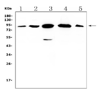 Anti-Gelsolin Gsn Antibody (Monoclonal, GS-2C4)