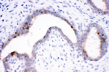 Anti-HSP70 Hspa1b Antibody (Monoclonal, BRM-22)