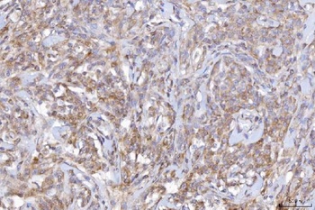 CD10/MME Antibody