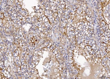 CD10/MME Antibody