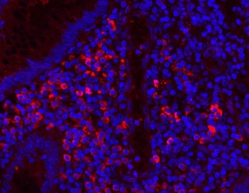 Myeloperoxidase/MPO Antibody