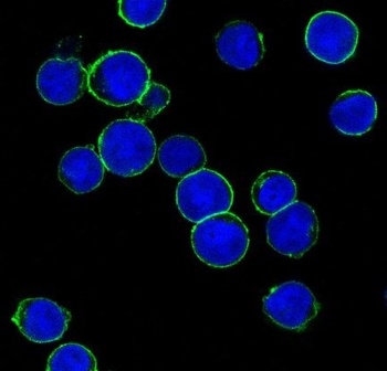 ErbB2 (HER2) Monoclonal Antibody