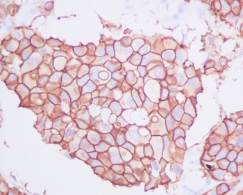 ErbB2 (HER2) Monoclonal Antibody
