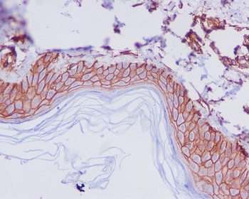 CD44 Rabbit Monoclonal Antibody