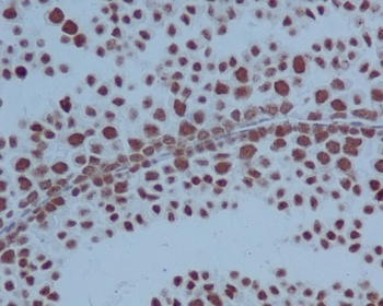 PARP PARP1 Rabbit Monoclonal Antibody