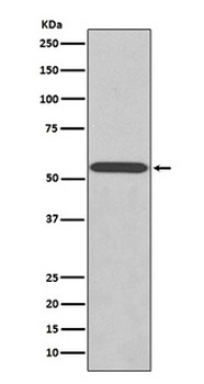 Wilms Tumor Protein WT1 Rabbit Monoclonal Antibody