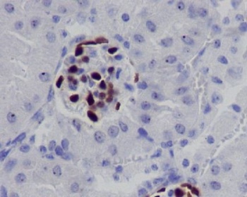 Wilms Tumor Protein WT1 Rabbit Monoclonal Antibody