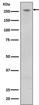 LRRK2 Rabbit Monoclonal Antibody