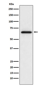 MMP2 Monoclonal Antibody