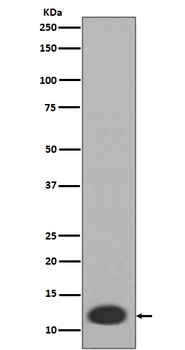 MRP8 S100A8 Rabbit Monoclonal Antibody