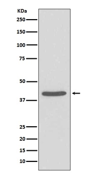 SIRT2/Sirtuin 2 Rabbit Monoclonal Antibody