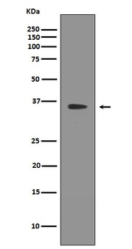 SIRT2/Sirtuin 2 Rabbit Monoclonal Antibody