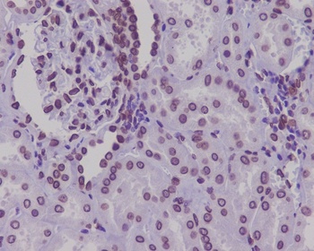 Lamin A/C LMNA Rabbit Monoclonal Antibody