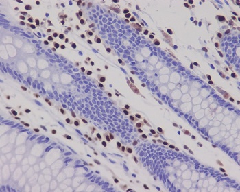 RUNX2 Monoclonal Antibody