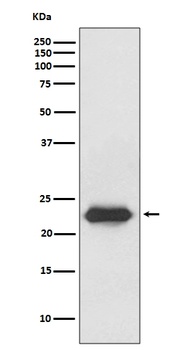 Lipocalin-2 LCN2 Rabbit Monoclonal Antibody