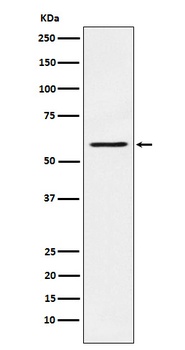 PAK1 Monoclonal Antibody